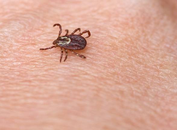 Officials: Upstate New York man died from rare tick-borne virus Officials: Upstate New York man died from rare tick-borne virus